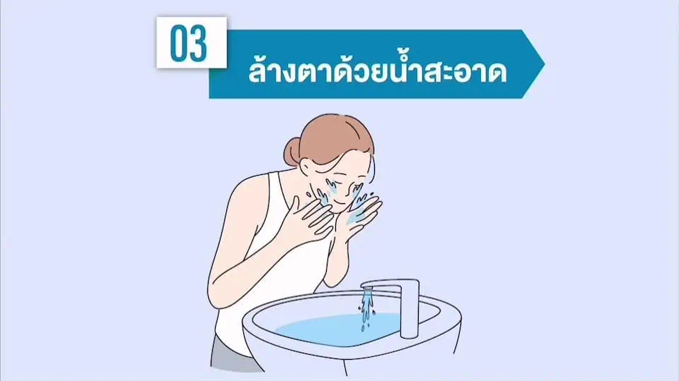 แพทย์ มช. เตือน 5 โรคร้ายจากฝุ่น PM 2.5 แนะวิธีถนอมดวงตารับมือฝุ่นควัน