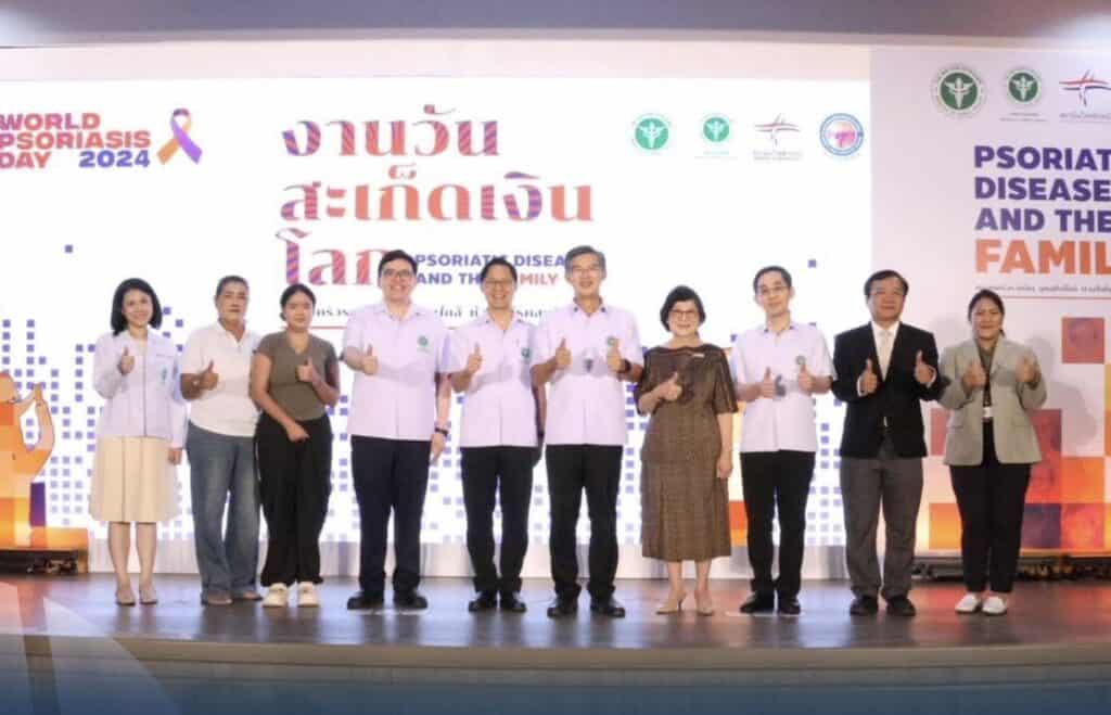 สถาบันโรคผิวหนัง จัดงานวันสะเก็ดเงินโลก หวังสร้างความตระหนักรู้ให้แก่ผู้ป่วย และคนทั่วไป เสริมสร้างคุณภาพชีวิตที่ดีขึ้น สถาบันโรคผิวหนัง จัดงานวันสะเก็ดเงินโลก หวังสร้างความตระหนักรู้ให้แก่ผู้ป่วย และคนทั่วไป เสริมสร้างคุณภาพชีวิตที่ดีขึ้น